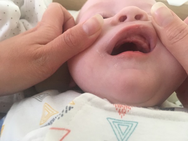 Teething already?