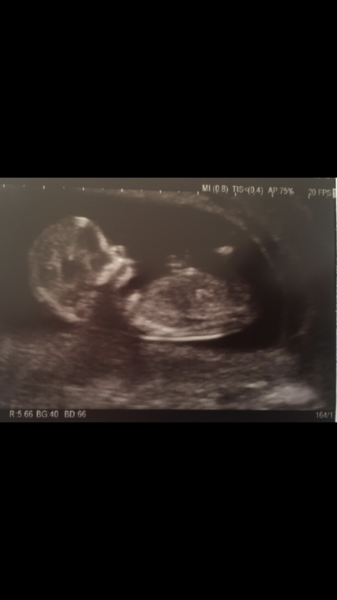 December 2018 Babies - Thread #3