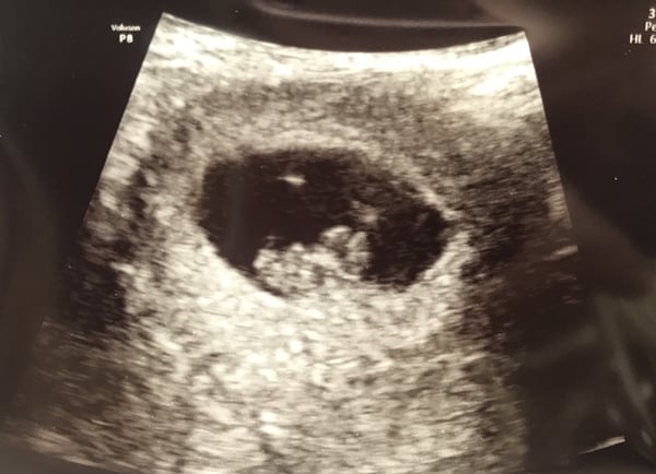 Due March 2019
