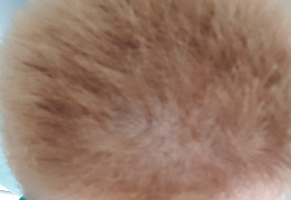 Head like a ball!
