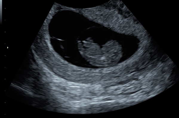 The March-ers (2019) #3