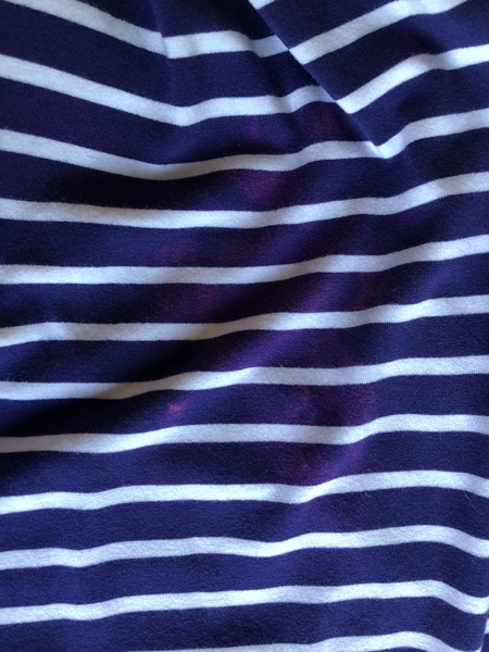 Bollocks. Vanish has ruined my dress, can I dye it??