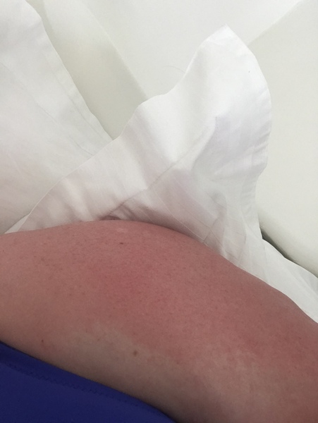 To think you can get a tan in the shade