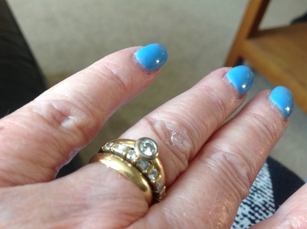 Wedding ring dilema show me yours