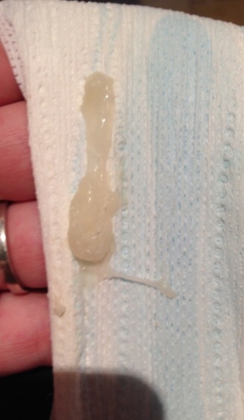 TMI (with pics) FTM mucus plug question...