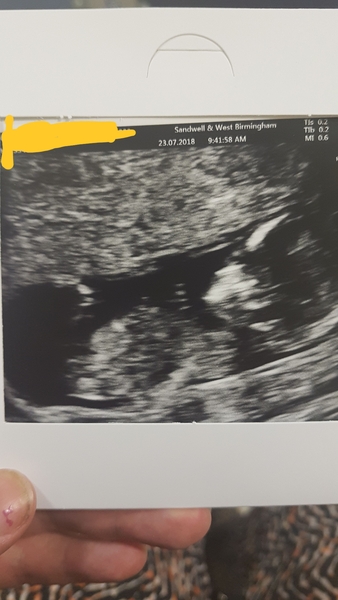Due January 2019 (2nd thread)