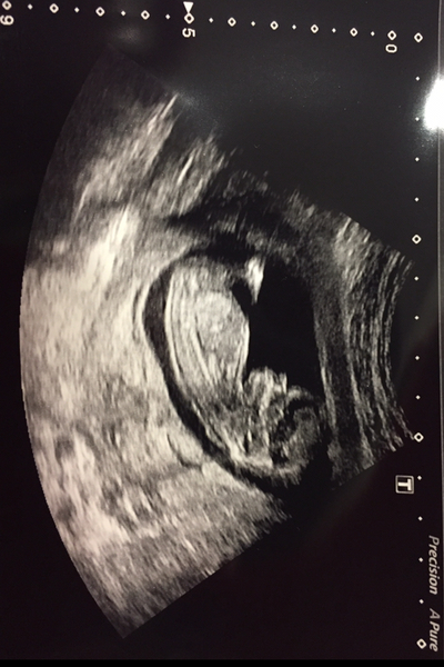 Due January 2019 (2nd thread)