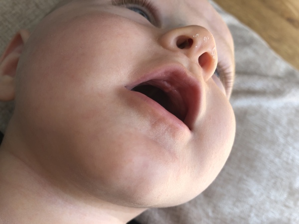 First tooth?