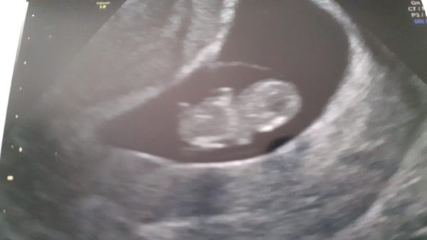 The March-ers (2019) #3