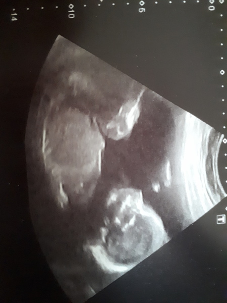 December 2018 Babies - Thread #3