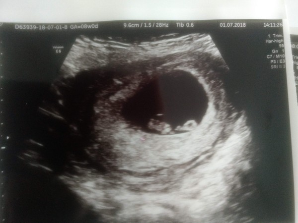 Due February 2019 part 2