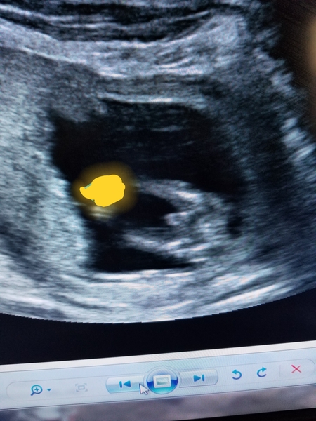Guess the Gender...