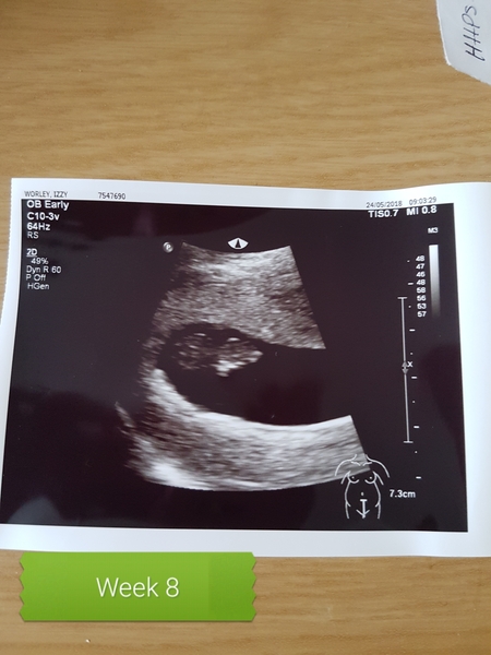 What can I expect to see on a scan at seven weeks?