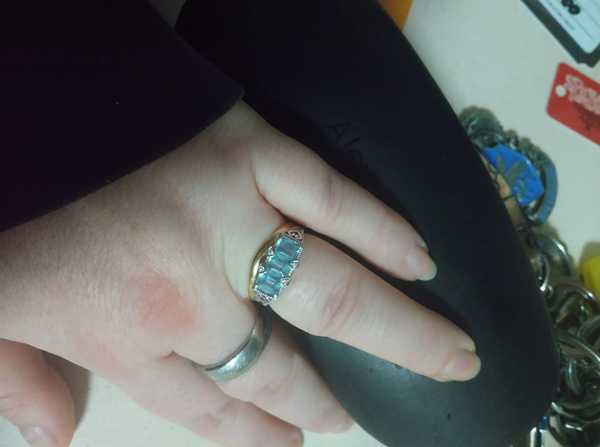 Wedding ring dilema show me yours