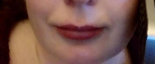 Sooo, who’s tried lip fillers?!