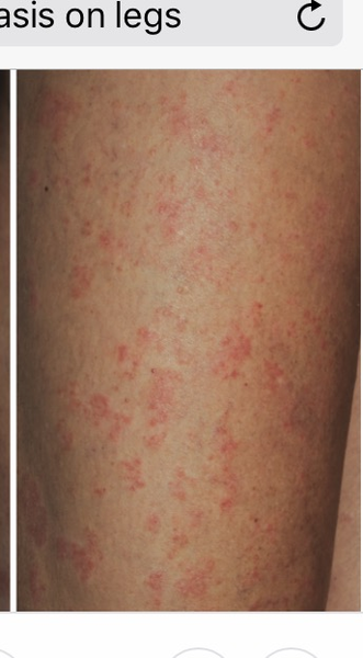 What is this on DP's legs?