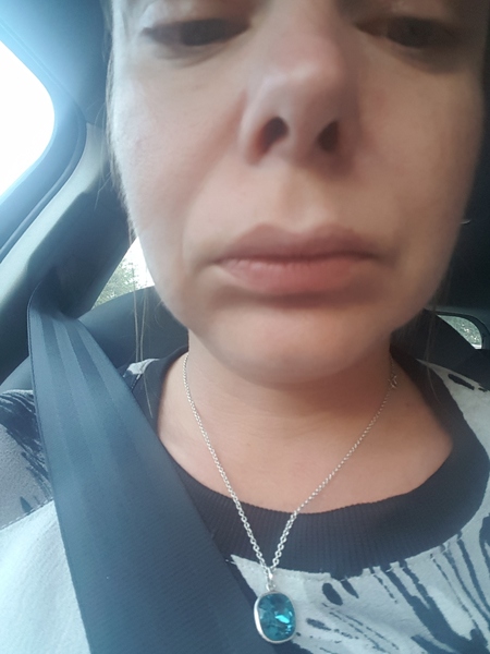 I'm a botox nurse AMA.