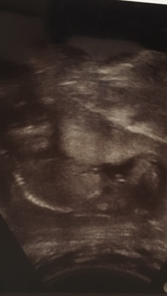 Gender scan says boy - show me yours!