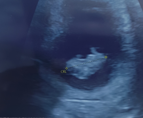 The March-ers (2019) #2