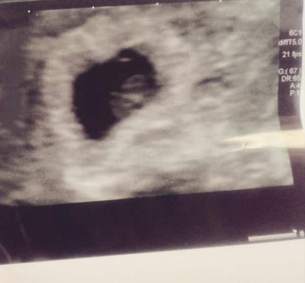 What can I expect to see on a scan at seven weeks?