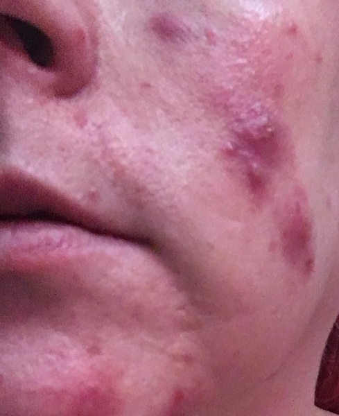 To ask if there is anything I could do with my skin (photo)