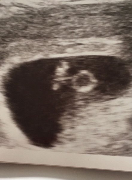 What can I expect to see on a scan at seven weeks?