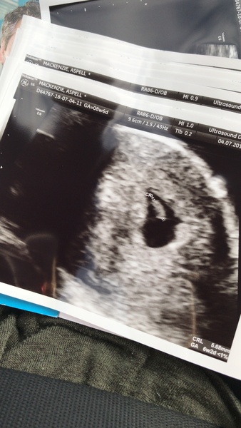 Due February 2019 part 2