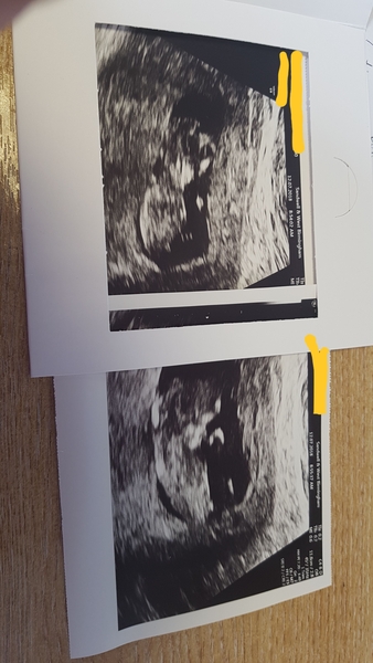 Due January 2019 (2nd thread)