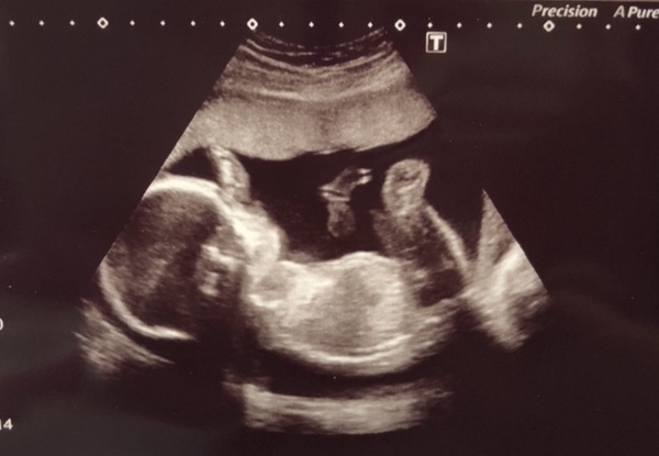 December 2018 Babies - Thread #3