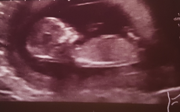 Boy or girl?