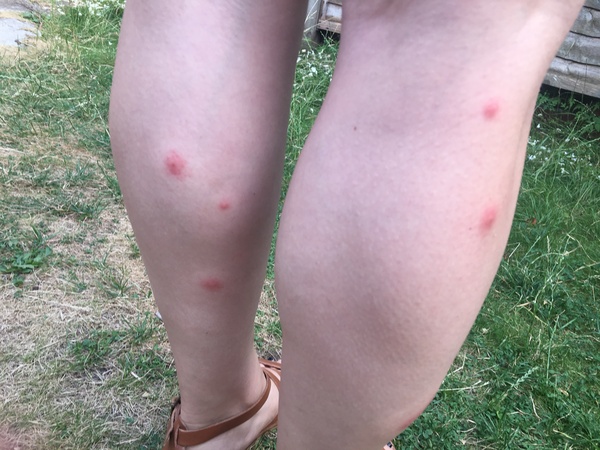 To think booking.com shouldn’t be listing properties with repeated reports od bed bugs