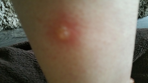 HORSE FLIES ARE A-HOLES.