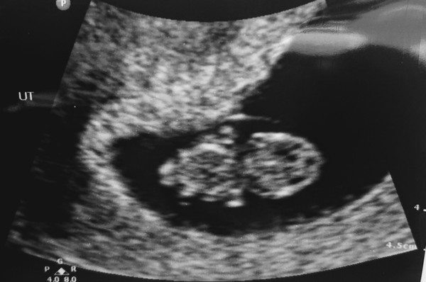 The March-ers (2019) #3