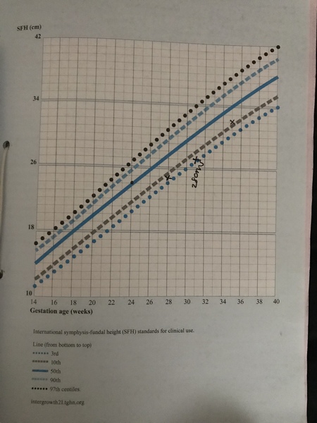 August 2018 #6 - Impending Births and The Final Push!