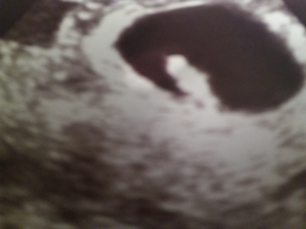 I’m a consultant gynaecologist - AMA