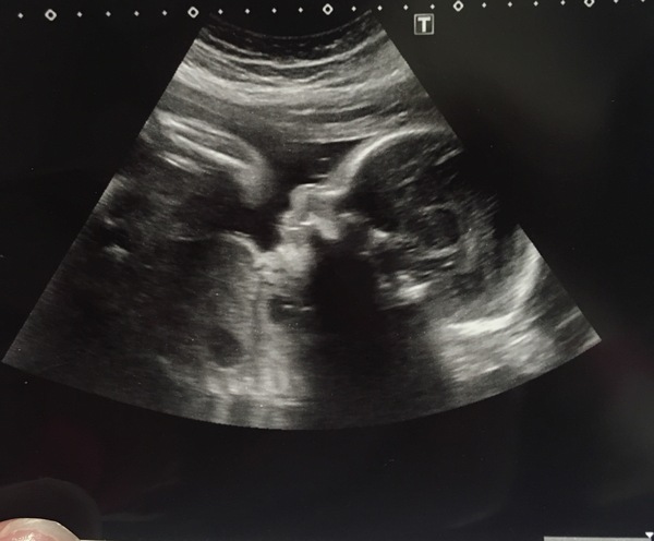 Growth Scan