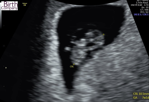 The March-ers (2019) #2