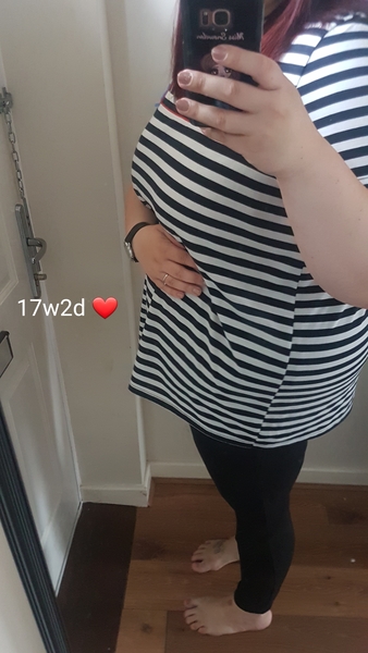 Baby bump