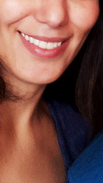 Sooo, who’s tried lip fillers?!