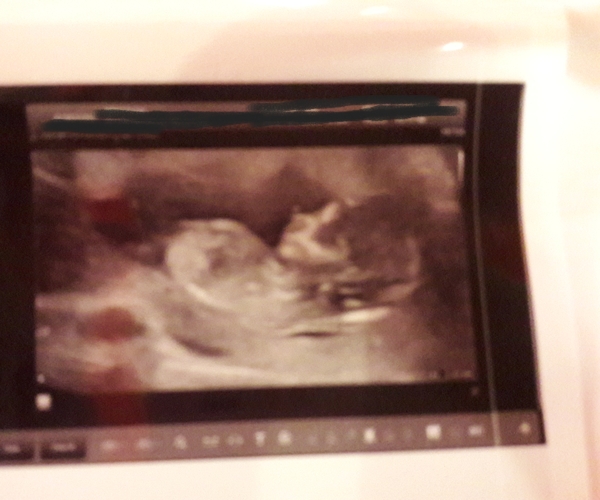 Due January 2019 (2nd thread)