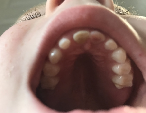 I’m a dentist - AMA