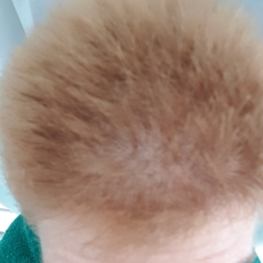 Head like a ball!