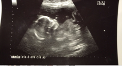 Boy or girl