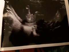Gender scan says boy - show me yours!