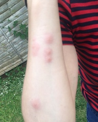 To think booking.com shouldn’t be listing properties with repeated reports od bed bugs