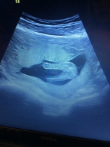 Gender scan 15 weeks, sonogrpaher said it was girl but I thought boy, please see