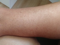 Can anyone tell me what's going on with my legs please? Photos included.