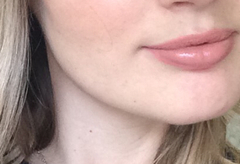 Sooo, who’s tried lip fillers?!