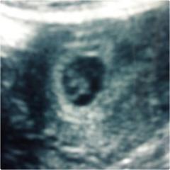 What can I expect to see on a scan at seven weeks?