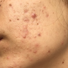 To ask if there is anything I could do with my skin (photo)